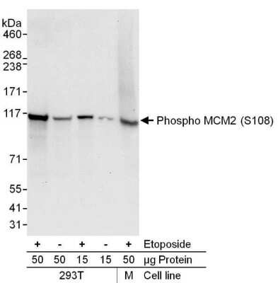 Western Blot: MCM2 [p Ser108] Antibody [NB100-639]